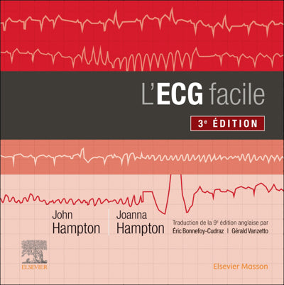 ECG facile