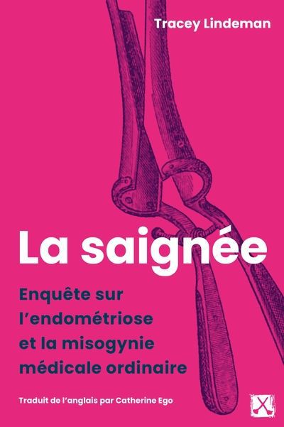 SAIGNEE