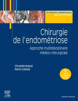 CHIRURGIE DE L'ENDOMÉTRIOSE