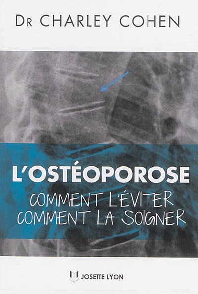 OSTÉOPOROSE COMMENT LÉVITER - COMMENT LA SOIGNER