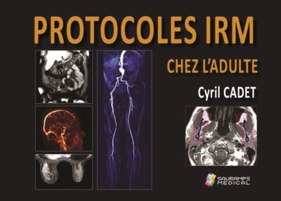 Protocoles IRM chez l'adulte